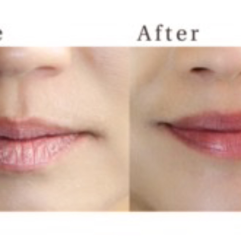 ❤️ NEW! Hanalei Lip Treatment - Picture 5 of 5